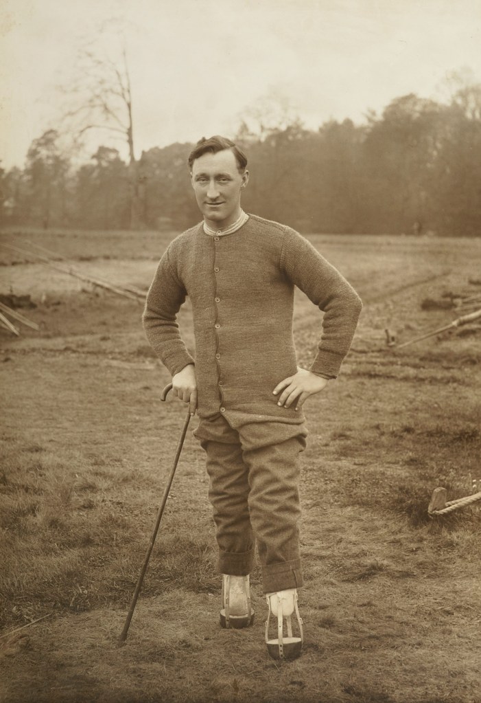 A soldier with amputated feet posing in the grounds of a park