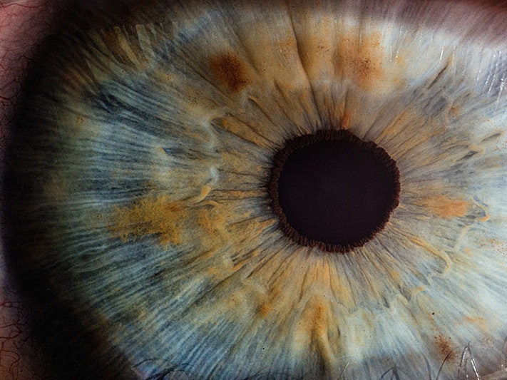 Macro photo of an eye, 2017. Photo by v2osk / Unsplash An extreme close-up of someone’s eyeball